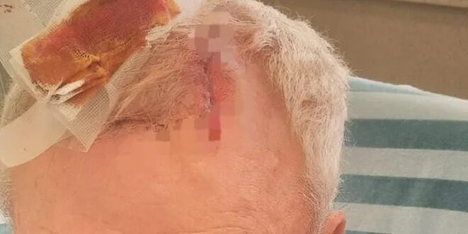 لائحة اتهام ضد شاب ضرب رجلاً مسناً على رأسه – شاهد التوثيق